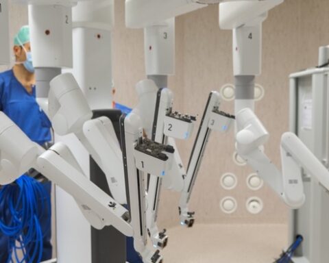 Nella foto il robot chirurgico utilizzato all’ospedale San Salvatore dell’Aquila, protagonista dell’intervento combinato di asportazione di tumori a rene e prostata