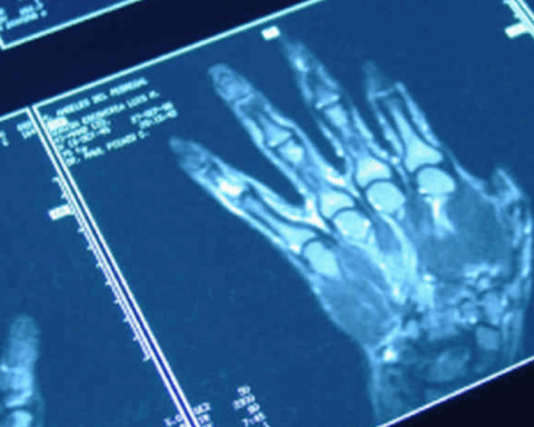 Sanità digitale, in Abruzzo i referti radiologici sono consultabili online