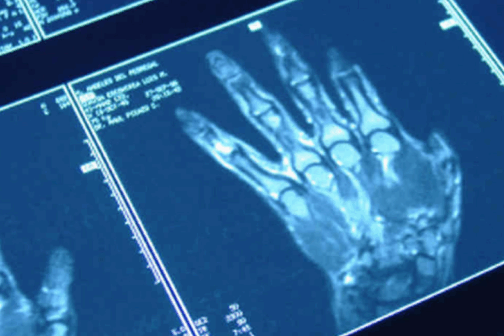 Sanità digitale, in Abruzzo i referti radiologici sono consultabili online