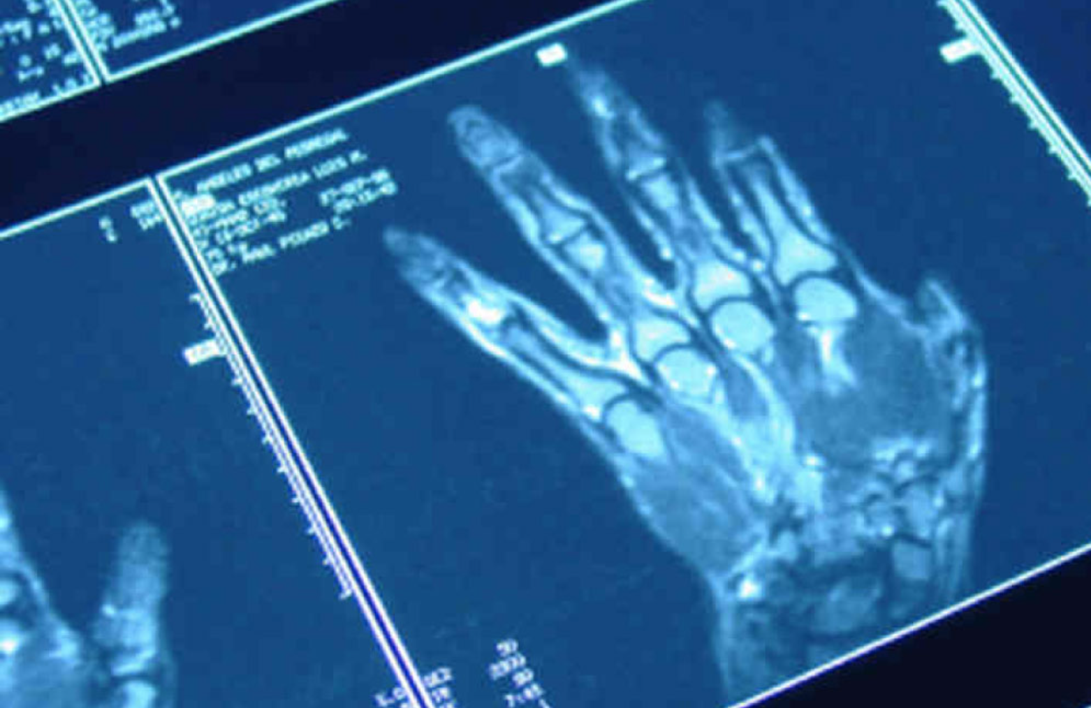 Sanità digitale, in Abruzzo i referti radiologici sono consultabili online